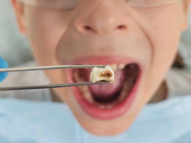 Best Emergency Treatment for Toothache in Goodwell, OK